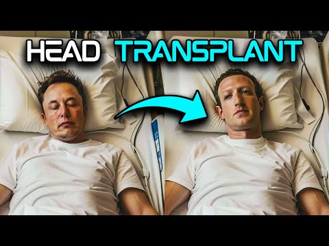 AI-Powered Head Transplant System SHOCKS the Industry